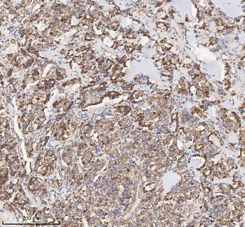 HADH Rabbit Polyclonal Antibody