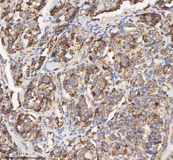 HADH Rabbit Polyclonal Antibody