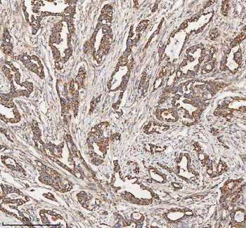 HADH Rabbit Polyclonal Antibody