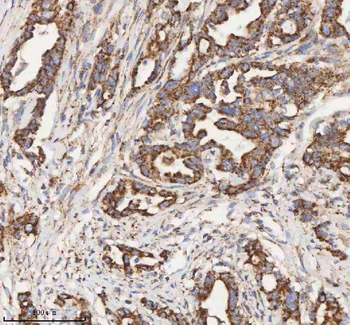 HADH Rabbit Polyclonal Antibody