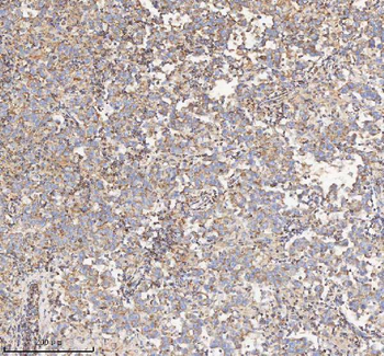 HADH Rabbit Polyclonal Antibody
