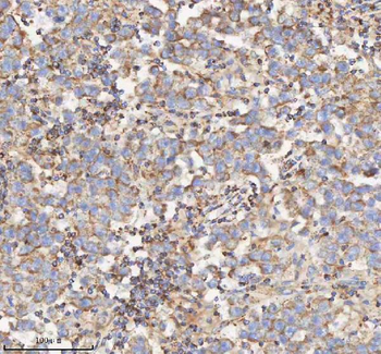 HADH Rabbit Polyclonal Antibody