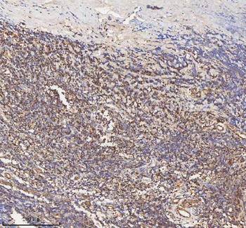 HADH Rabbit Polyclonal Antibody