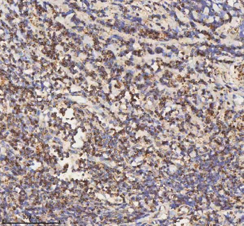 HADH Rabbit Polyclonal Antibody
