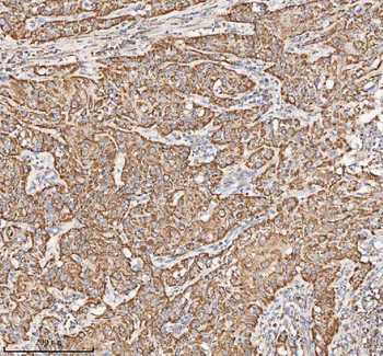 HADH Rabbit Polyclonal Antibody