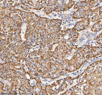 HADH Rabbit Polyclonal Antibody