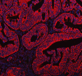 HADH Rabbit Polyclonal Antibody