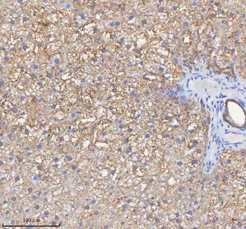 HADH Rabbit Polyclonal Antibody