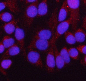HADH Rabbit Polyclonal Antibody
