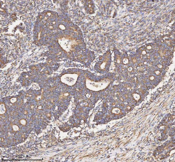 HADH Rabbit Polyclonal Antibody