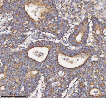 HADH Rabbit Polyclonal Antibody
