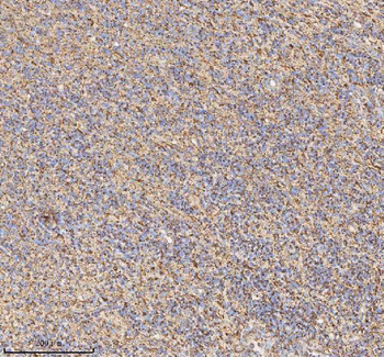 HADH Rabbit Polyclonal Antibody