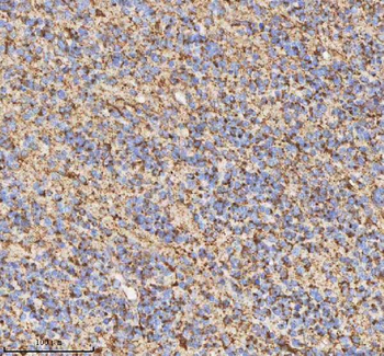 HADH Rabbit Polyclonal Antibody