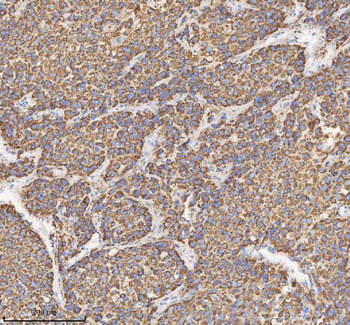 HADH Rabbit Polyclonal Antibody