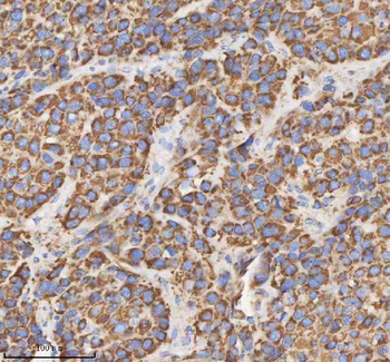 HADH Rabbit Polyclonal Antibody
