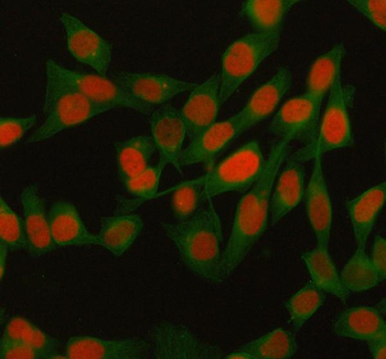H2AFY/MACROH2A1 Rabbit Polyclonal Antibody