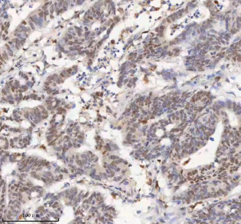 H2AFY/MACROH2A1 Rabbit Polyclonal Antibody