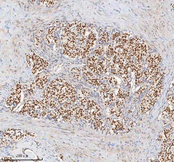 H2AFY/MACROH2A1 Rabbit Polyclonal Antibody