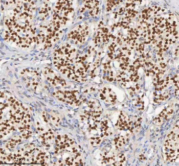 H2AFY/MACROH2A1 Rabbit Polyclonal Antibody