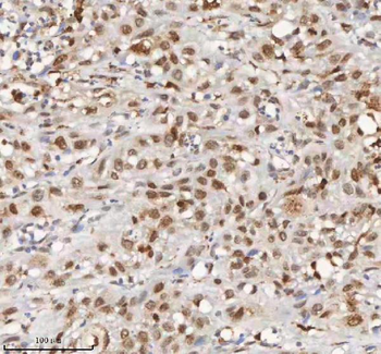 H2AFY/MACROH2A1 Rabbit Polyclonal Antibody