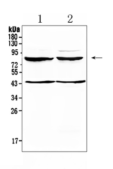 TSH Receptor/TSHR Rabbit Polyclonal Antibody