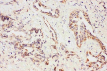 Eotaxin 3/CCL26 Rabbit Polyclonal Antibody
