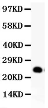 GDNF Rabbit Polyclonal Antibody