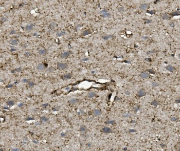 VEGF/VEGFA Rabbit Polyclonal Antibody