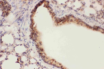 15 Lipoxygenase 1/ALOX15 Rabbit Polyclonal Antibody