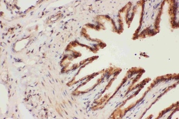 15 Lipoxygenase 1/ALOX15 Rabbit Polyclonal Antibody
