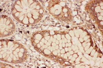 15 Lipoxygenase 1/ALOX15 Rabbit Polyclonal Antibody