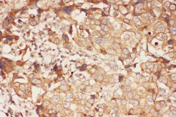 15 Lipoxygenase 1/ALOX15 Rabbit Polyclonal Antibody