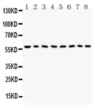 Beclin 1/BECN1 Rabbit Polyclonal Antibody