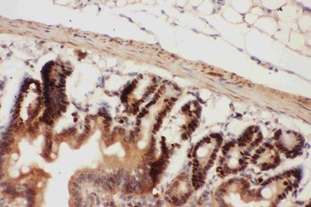 Beclin 1/BECN1 Rabbit Polyclonal Antibody