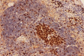 Beclin 1/BECN1 Rabbit Polyclonal Antibody