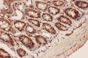 Beclin 1/BECN1 Rabbit Polyclonal Antibody