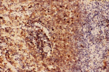 Beclin 1/BECN1 Rabbit Polyclonal Antibody