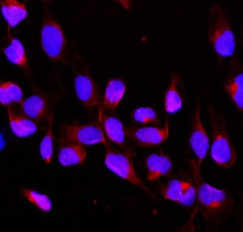 CBL Rabbit Polyclonal Antibody