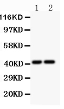 CXCR3 Rabbit Polyclonal Antibody