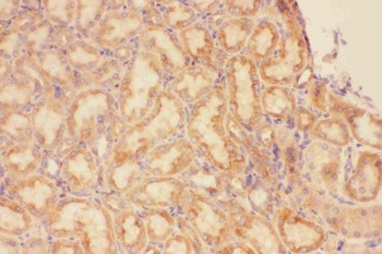 CXCR3 Rabbit Polyclonal Antibody