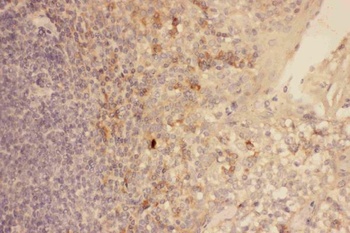CXCR3 Rabbit Polyclonal Antibody