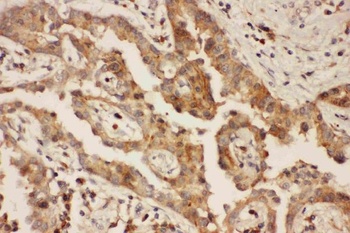 CXCR3 Rabbit Polyclonal Antibody