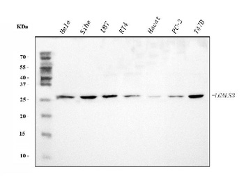 Galectin 3/LGALS3 Rabbit Polyclonal Antibody