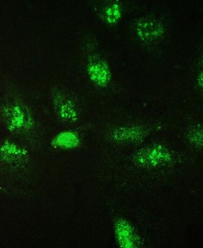 Galectin 3/LGALS3 Rabbit Polyclonal Antibody