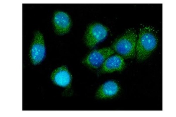 Galectin 3/LGALS3 Rabbit Polyclonal Antibody