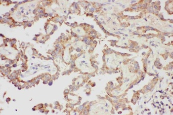 Galectin 3/LGALS3 Rabbit Polyclonal Antibody