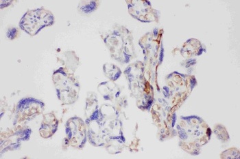 Galectin 3/LGALS3 Rabbit Polyclonal Antibody