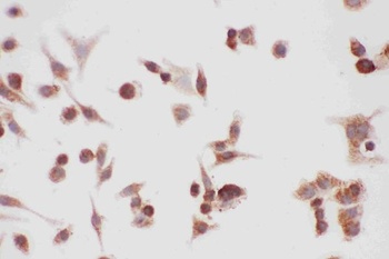 Hsp90 alpha/HSP90AA1 Rabbit Polyclonal Antibody