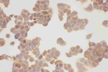 Hsp90 alpha/HSP90AA1 Rabbit Polyclonal Antibody