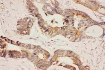 Hsp90 alpha/HSP90AA1 Rabbit Polyclonal Antibody